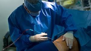 Is Liposuction in Dubai the Right Choice for Body Contouring?
